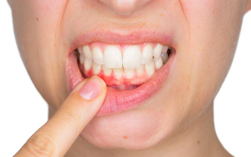 Periodontal-Gum-Treatment.jpg